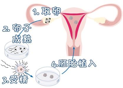 陈若晴 副院长